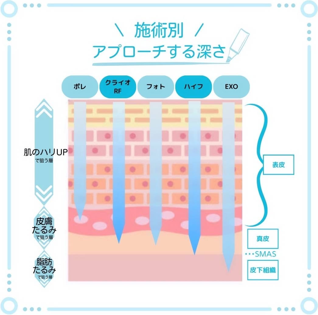 ラジオ波