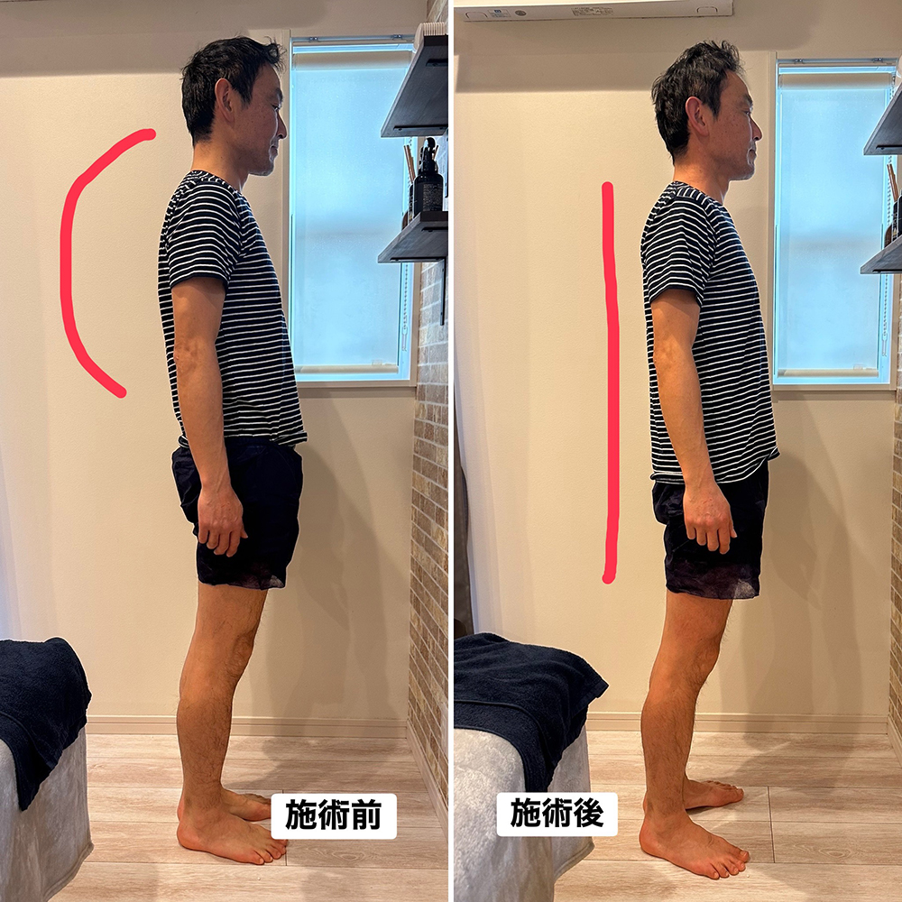 ヘッドスパのBefore＆After