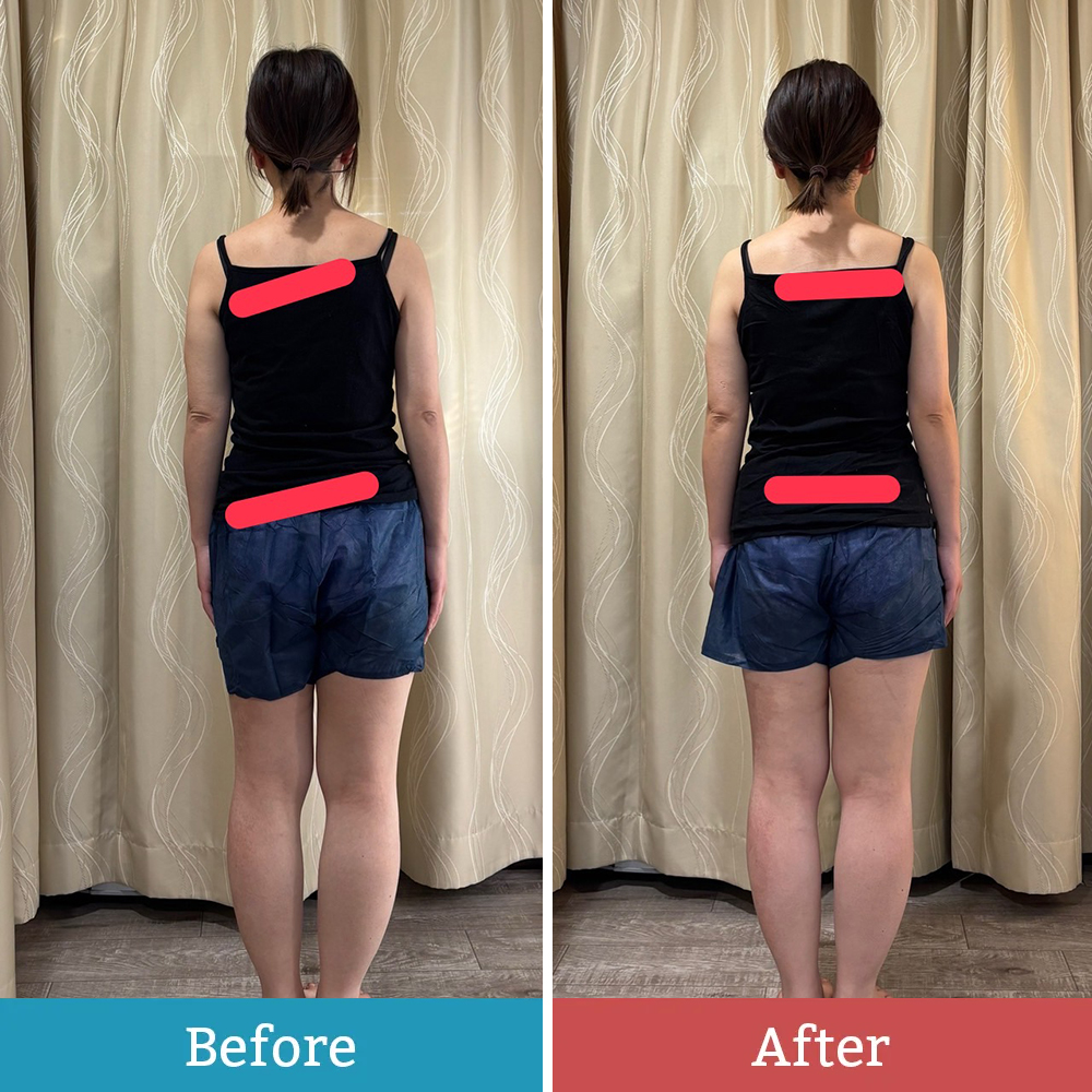 ヘッドスパのBefore＆After